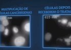 Brasileiro Revoluciona o Combate ao Câncer com Nova Terapia que 'Superaquece' Células Tumorais!