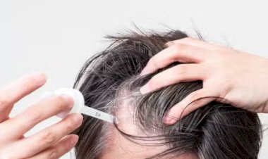 Anvisa alerta para risco de crescimento anormal de pelos em bebês expostos ao minoxidil