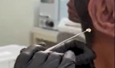 CERA DO OUVIDO PODE AJUDAR A ANTECIPAR DIAGNÓSTICO DO CÂNCER, APONTAM PESQUISADORES DA UFG